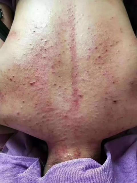长期熬夜会堵住大脑排泄系统吗