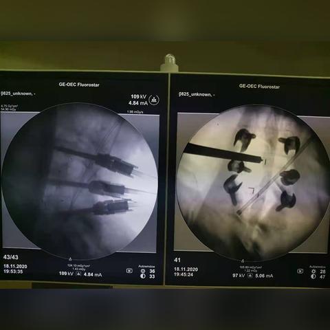 合肥较好的脊柱外科医院有哪些？