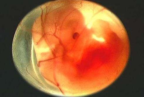 孕期出现这7大情况，很有可能是胎停育