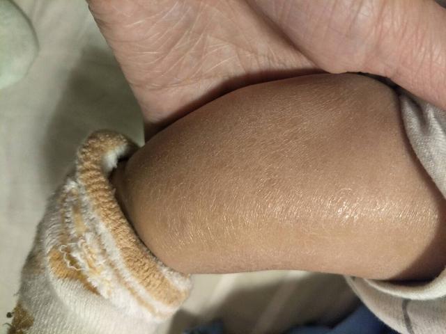 秋季润肤吃什么