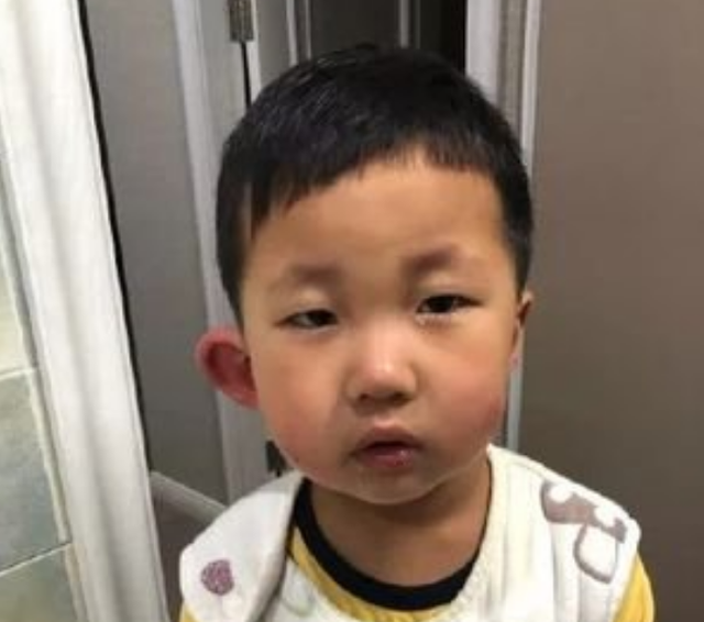 宝宝被蚊虫叮咬怎么办
