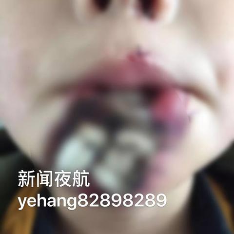 哈尔滨公安医院整形科相关长尾关键词有哪些
