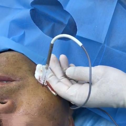 牙神经痛吃什么药