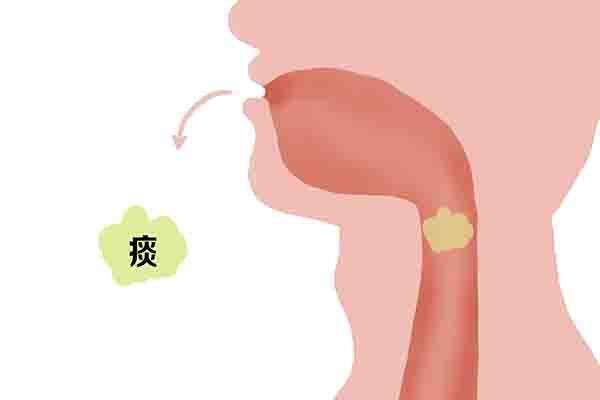 宝宝卡痰呼吸困难怎么办