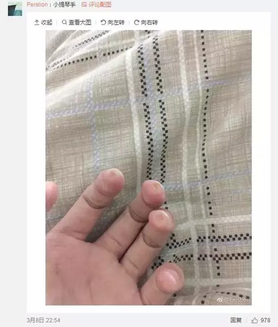 孩子喜欢吃手会变丑吗