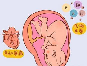 易致胎儿畸形的五种因素