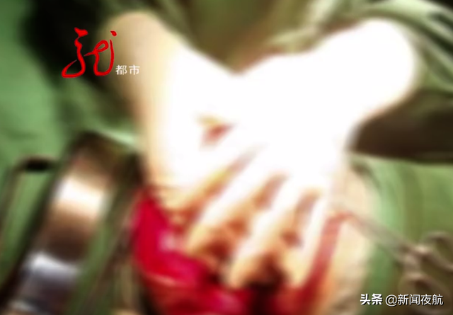 孩子磕到头必须做CT吗