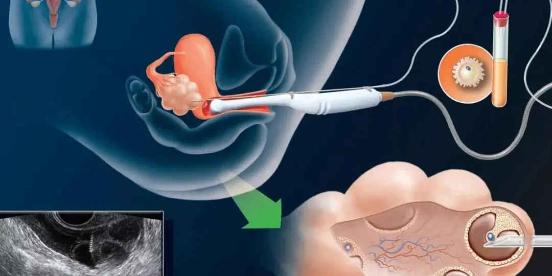 怎样努力一年赚10万元 一年如何赚10万元