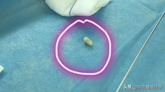 春节孩子被异物卡住了怎么办