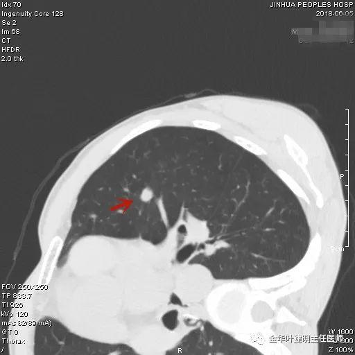 叶对生 圆形上面有毛刺 盆栽,叶子细长向四面散开像竹子却没有竹节是什么植物?