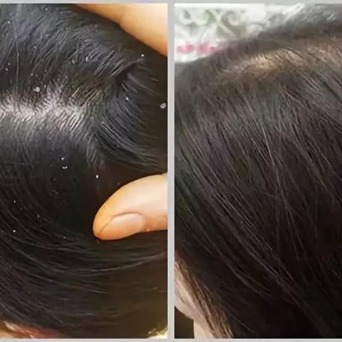 河南控油洗发水选择哪个