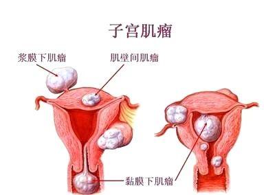 白带较多什么原因 白带较多什么原因