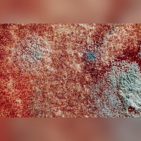 揭秘肝囊肿的形成过程：成因、发展与预防策略-第1张图片-其人生活百科