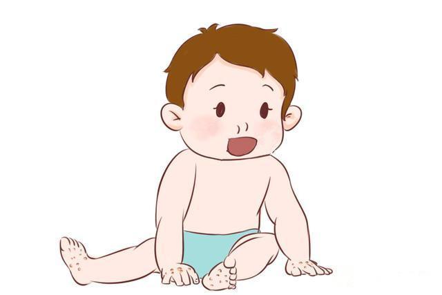 手足口病脸上会起疹子吗