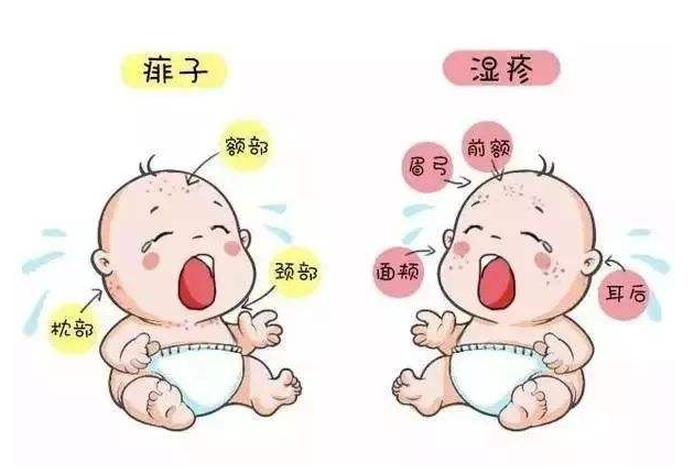 宝宝湿疹易发在哪些部位