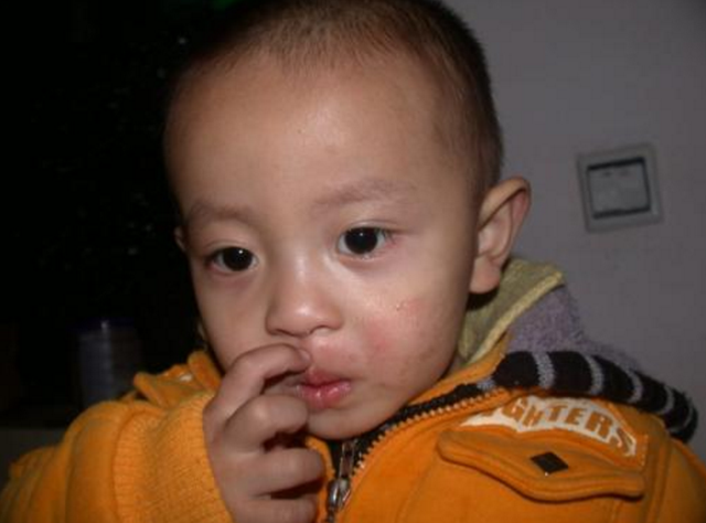 孩子喜欢挖鼻孔怎么办