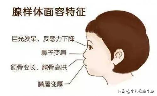 孩子腺样体肥大需要做手术吗?