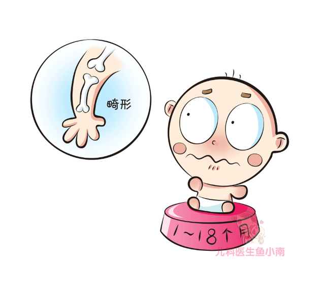 婴儿需要补充维生素D吗