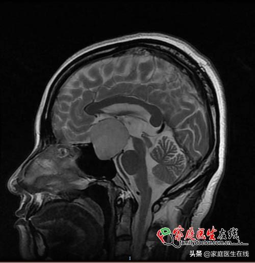 怀孕,不打没有准备的战 怀孕,不打没有准备的战