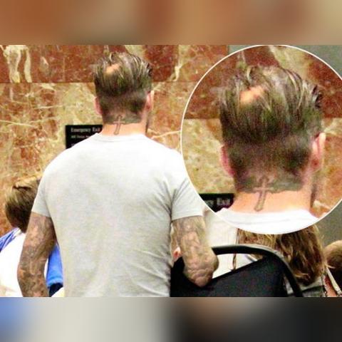 足球运动员后遗症秃头的长尾关键词有哪些