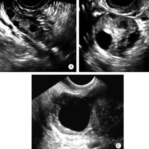 试管婴儿怀孕检查周期的相关长尾关键词有什么