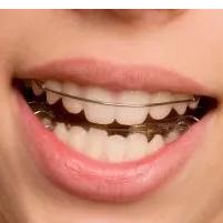 哈雷保持器和透明保持器哪个贵？