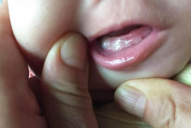 宝宝长牙期的辅食食谱