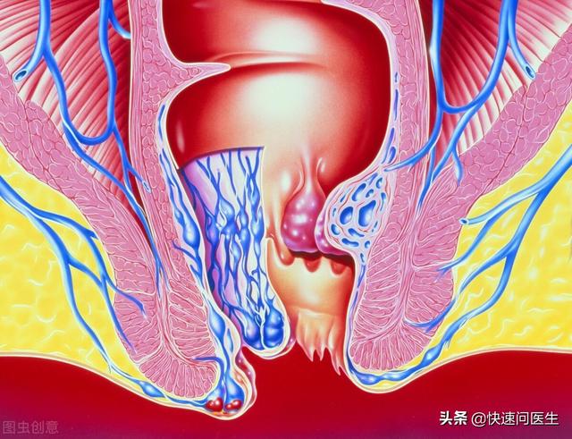 孩子得痔疮是正常的吗