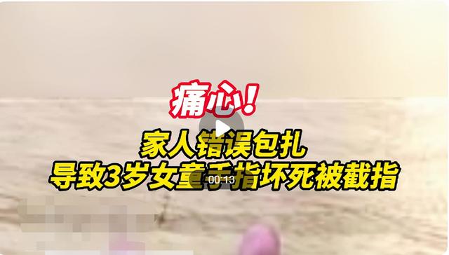宝宝手指头划伤了怎么办