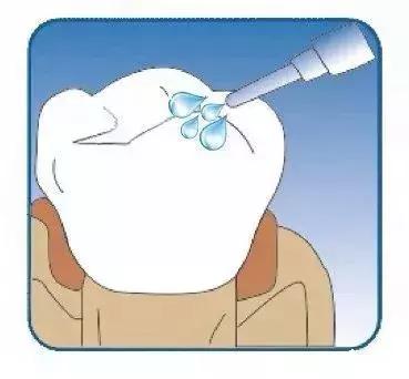 预防宝宝蛀牙