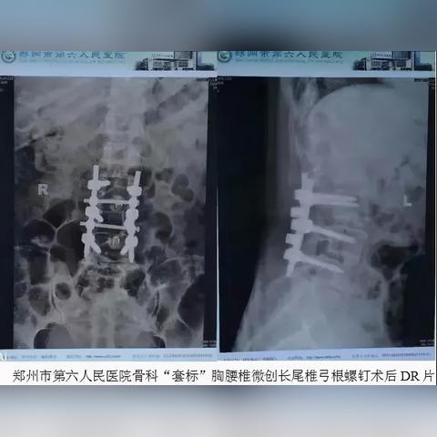 免费采购软件的长尾关键词有哪些