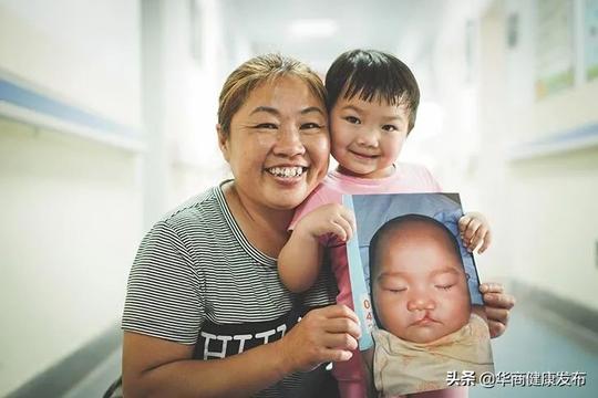 患者招募丨完全免费唇腭裂手术，唇腭裂专家在西安等你来