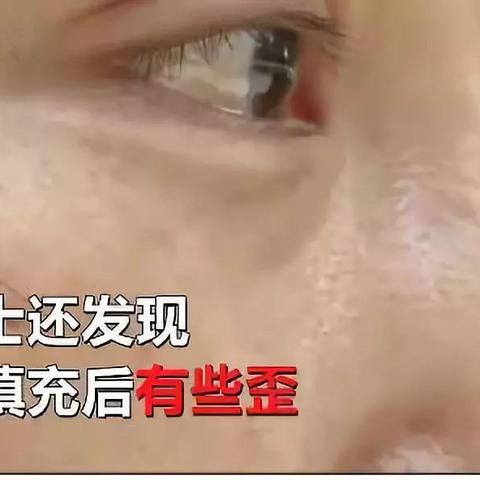 西安填充法令纹医生相关长尾关键词有哪些