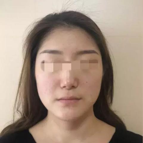 长沙 徒手整骨相关长尾关键词有哪些