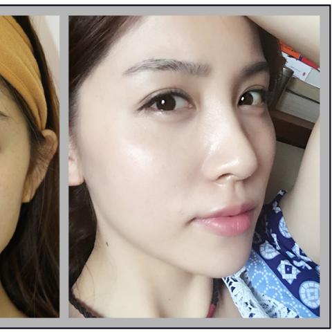 杭州激光整形医院的相关长尾关键词有哪些