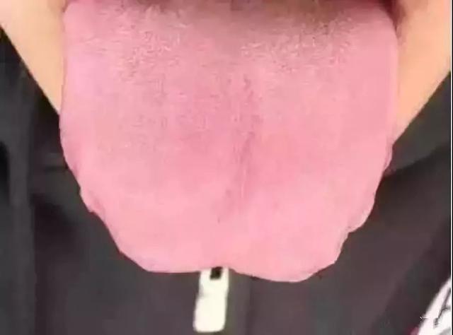 怎么判断宝宝是不是脾虚