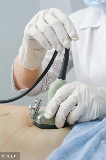 孕妇为什么会血液感染