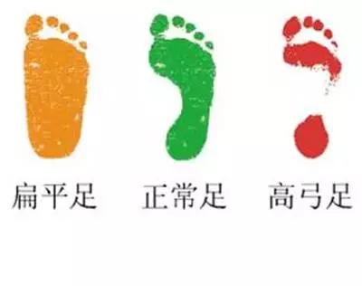 宝宝站立时脚外翻是什么原因