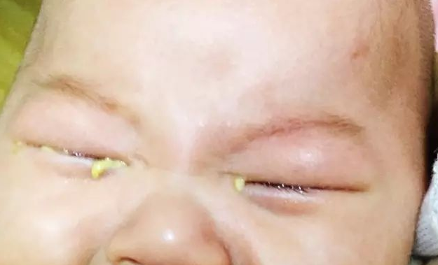 这些食疗方可缓解宝宝上火口臭