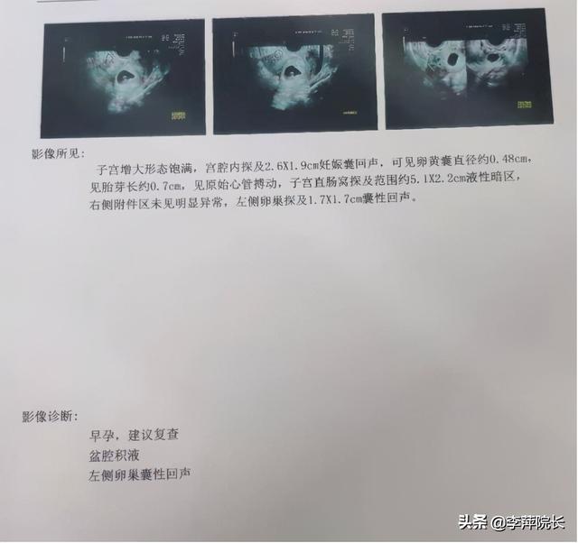 正常排卵怀不上是什么原因