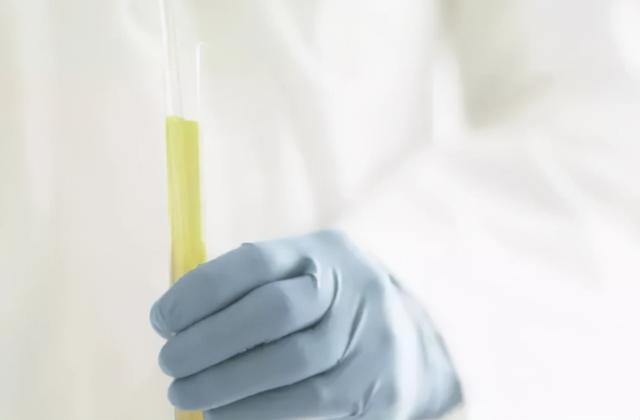 一喝水就想尿是肾不好吗