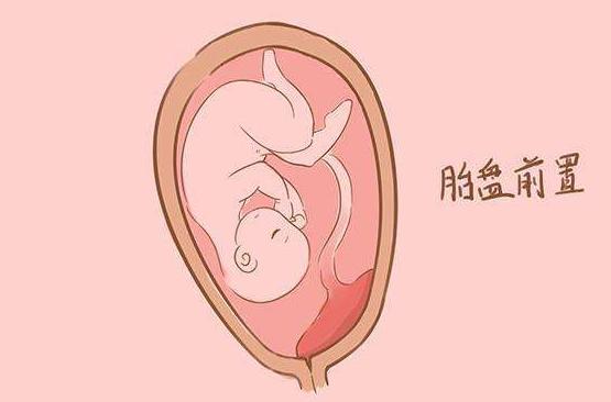 孕晚期胎儿缺氧有什么症状或征兆吗