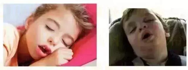 怎么判断孩子是不是口呼吸 怎么判断孩子是不是口呼吸