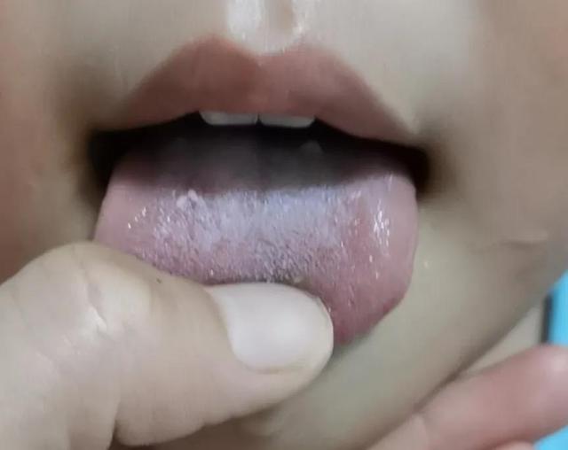 入园后经常生病