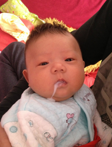 宝宝过度喂养有哪些症状