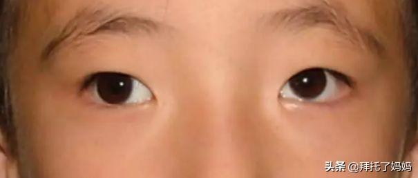 宝宝总是揉眼睛怎么办