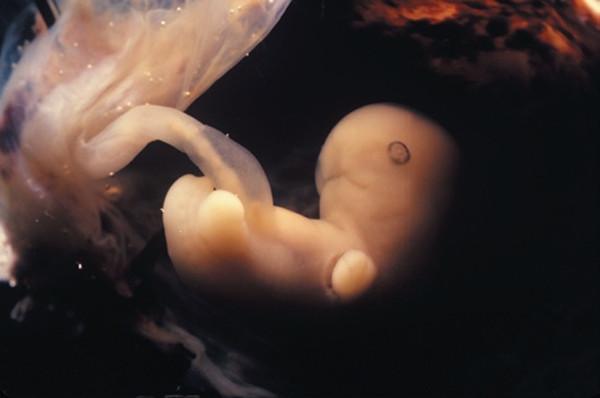 孕妇身体有这3种反应说明胎儿在发育