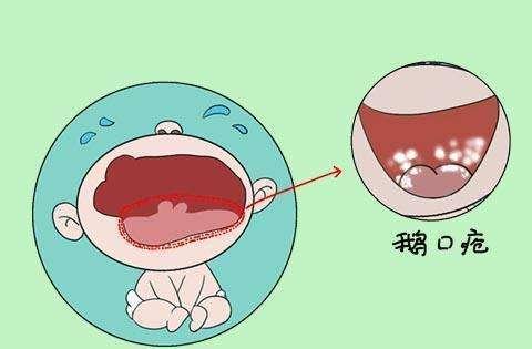 宝宝为什么会得败血症