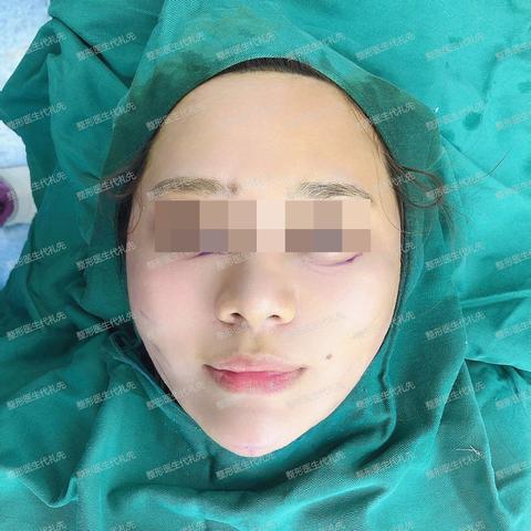 下颌缘广州相关长尾关键词有哪些