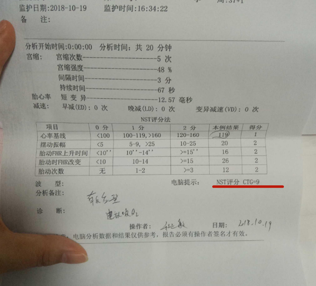 胎心监护的作用是什么